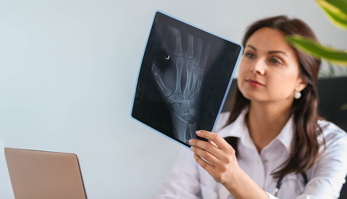 osteoporoza osteoporoza